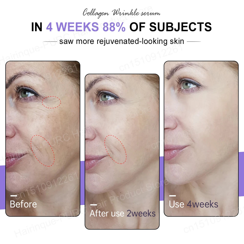 Revitalize Your Skin with Joypretty Collagen Face Serum - Anti-Aging, Lifting & Brightening Formula for Youthful Radiance